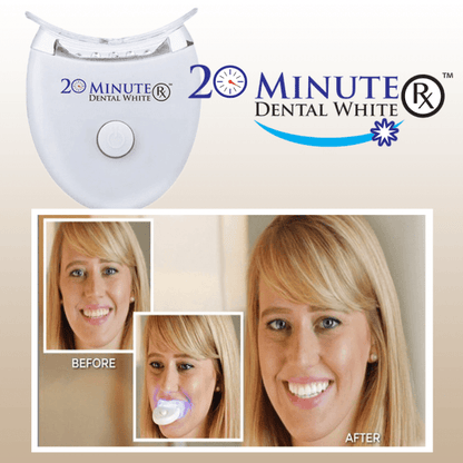 Dental White – Beli zubi za 20min